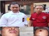 DPP PPRI SOROTI KINERJA PENYIDIK JATANTRAS POLRES METRO BEKASI DAN DESAK SEGERA TANGKAP PELAKU PENGEROKAN TERHADAP WARTAWAN