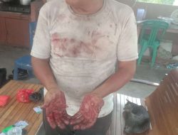 Kuasa Hukum Desak Polisi Tindaklanjuti Kasus Penganiayaan di Karimunting